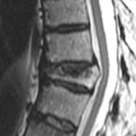 09-09-09-MRI