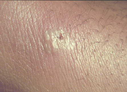 Case 5 - Figure 2