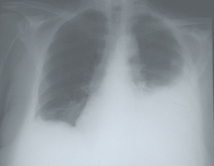 Case 6 - Figure 1