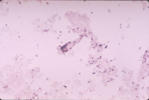 Case 6 - Figure 11