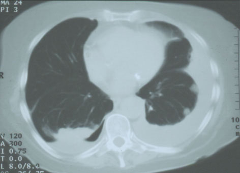 Case 6 - Figure 2
