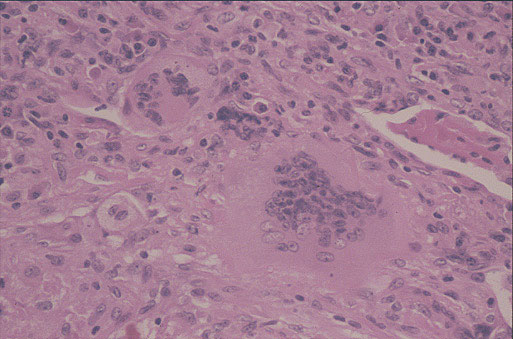 Case 6 - Figure 5