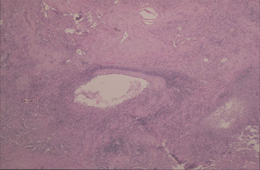 Case 6 - Figure 6
