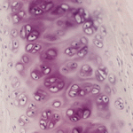 chicken-collagen