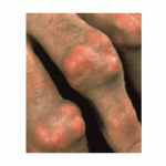 gout-08-10-02
