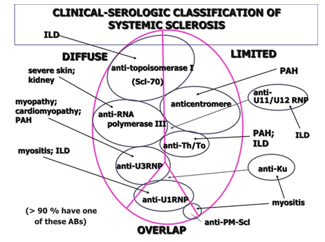 Researchers identify likely causes, treatment strategies for systemic scleroderma