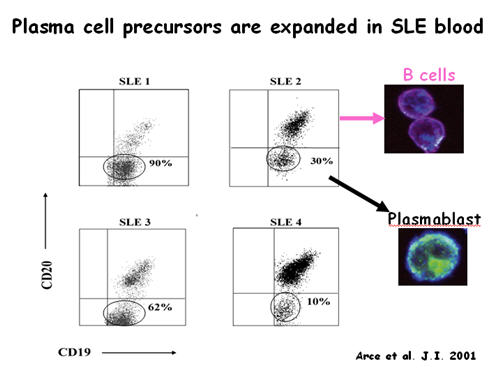 Plasma cell precursors are expanded in SLE Blood
