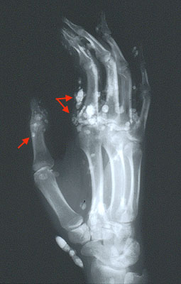 Slide 2a