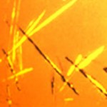 uric-acid-crystals