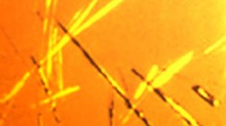 uric-acid-crystals