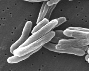 Electron Micrograph of Mycobacterium Tuberculosis