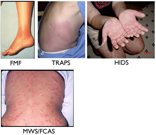 Most Common Types of Itchy Skin Rashes – Dermatology