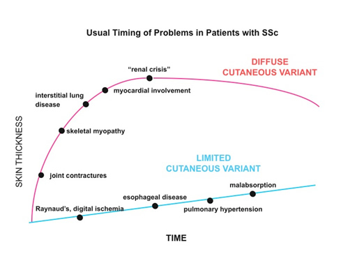 What is the typical prognosis for scleroderma?