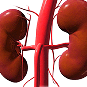 MMF vs AZA for SLE Nephritis