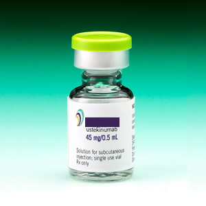 Ustekinumab (Stelara®) receives FDA approval for treatment of adults with active psoriatic arthritis
