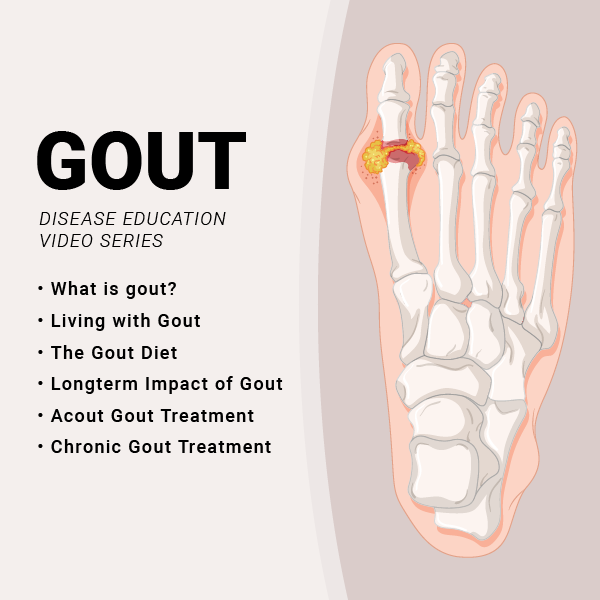 Gout Disease Education Video Series Learn About Gout Johns Hopkins