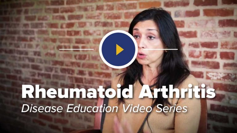 rheumatoid polyneuropathy with rheumatoid arthritis of both hands icd 10